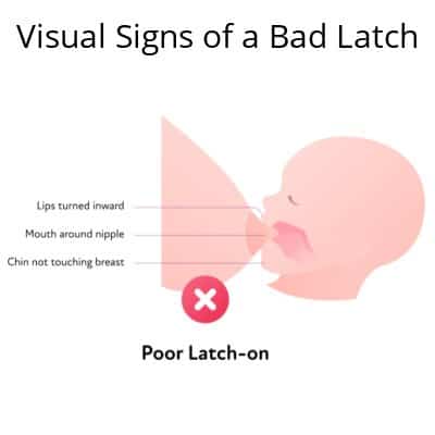 diagram of a newborn doing a bad latch while breastfeeding